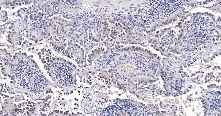 转录因子E2F-4重组兔单抗
