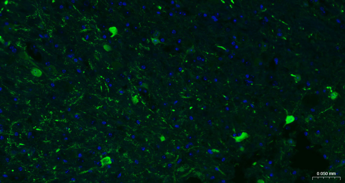 钙结合蛋白重组兔单抗