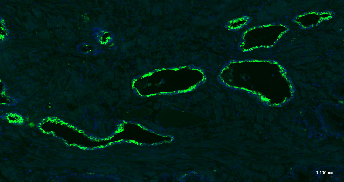细胞角蛋白7重组兔单抗