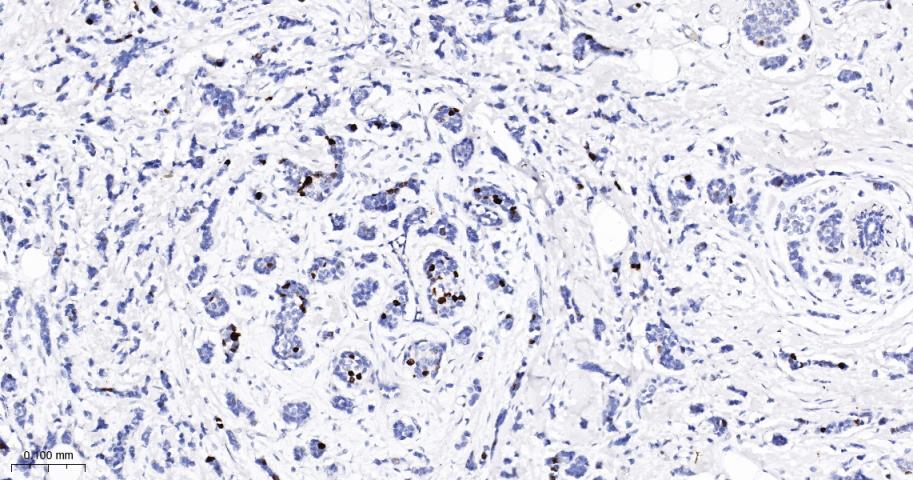 磷酸化核仁蛋白C23重组兔单抗-bsm-62916R