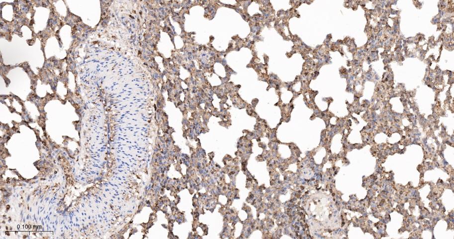 β-肌动蛋白/β-Actin(内参)抗体