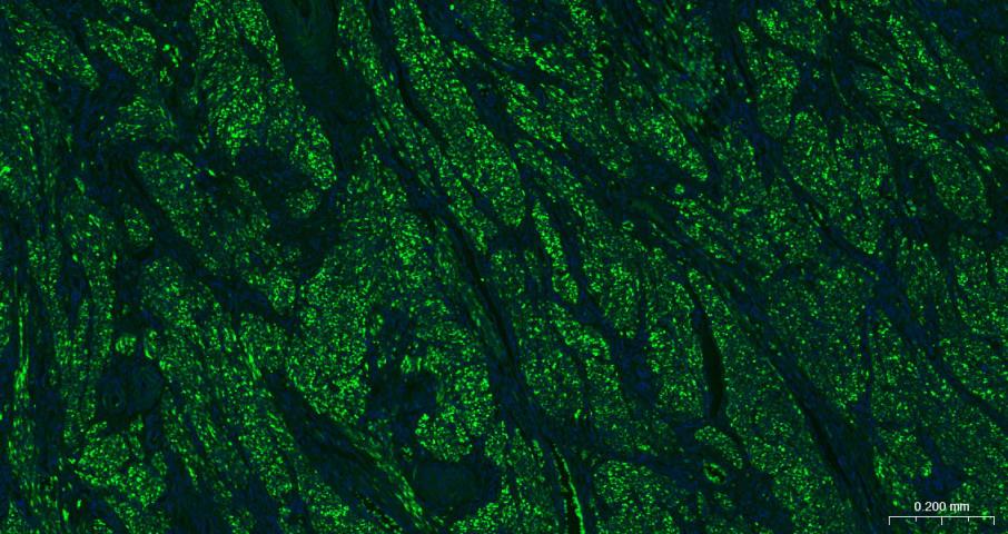 结蛋白单克隆抗体-bsm-33229M