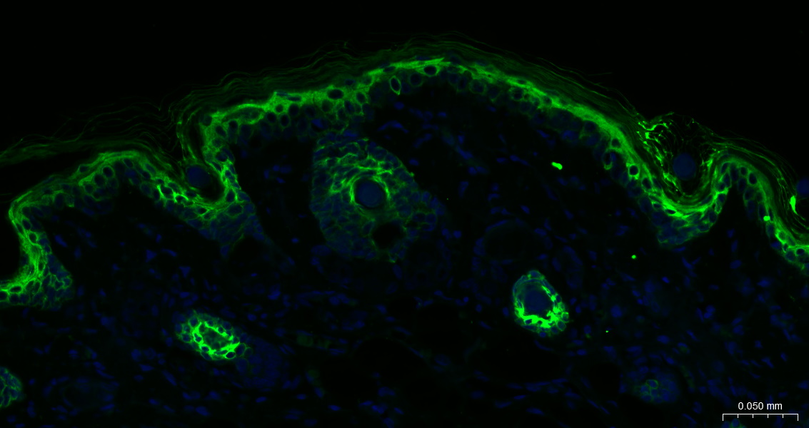 广谱细胞角蛋白PCK单克隆抗体