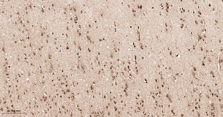 细胞内氯离子通道蛋白4重组兔单抗