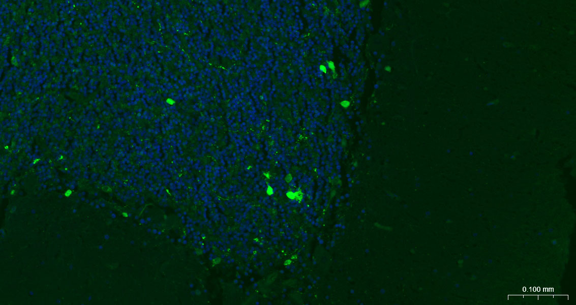 钙结合蛋白重组兔单抗