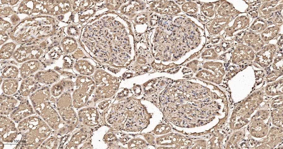细胞内氯离子通道蛋白4重组兔单抗