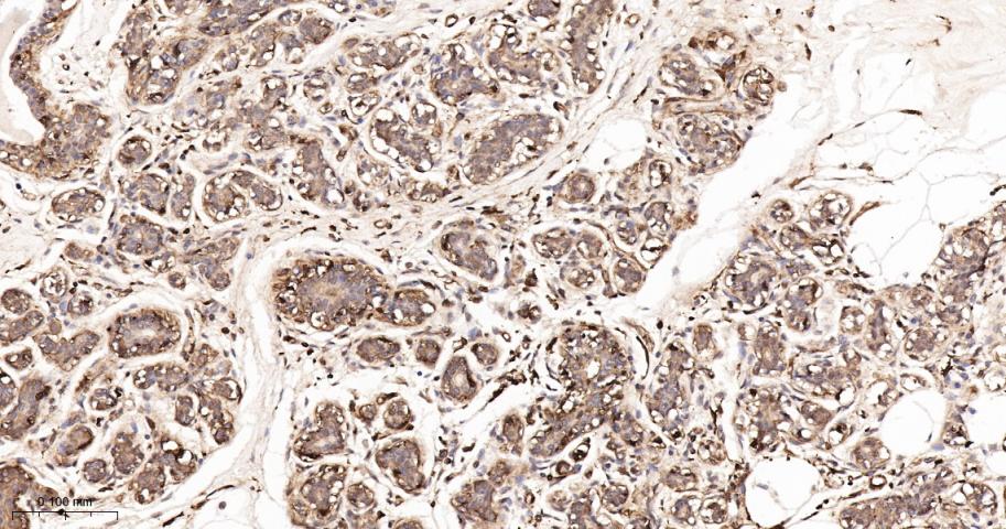 β-肌动蛋白/β-Actin(内参)抗体