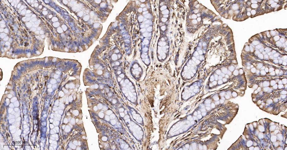 β-肌动蛋白/β-Actin(内参)抗体