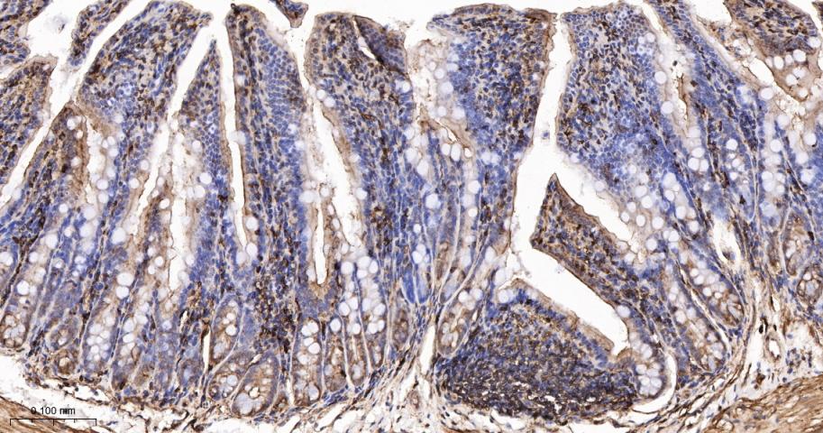β-肌动蛋白/β-Actin(内参)抗体