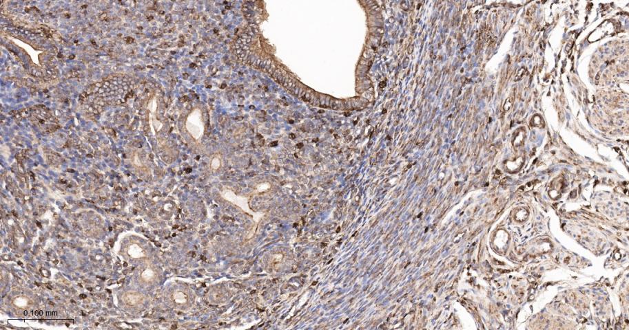 β-肌动蛋白/β-Actin(内参)抗体