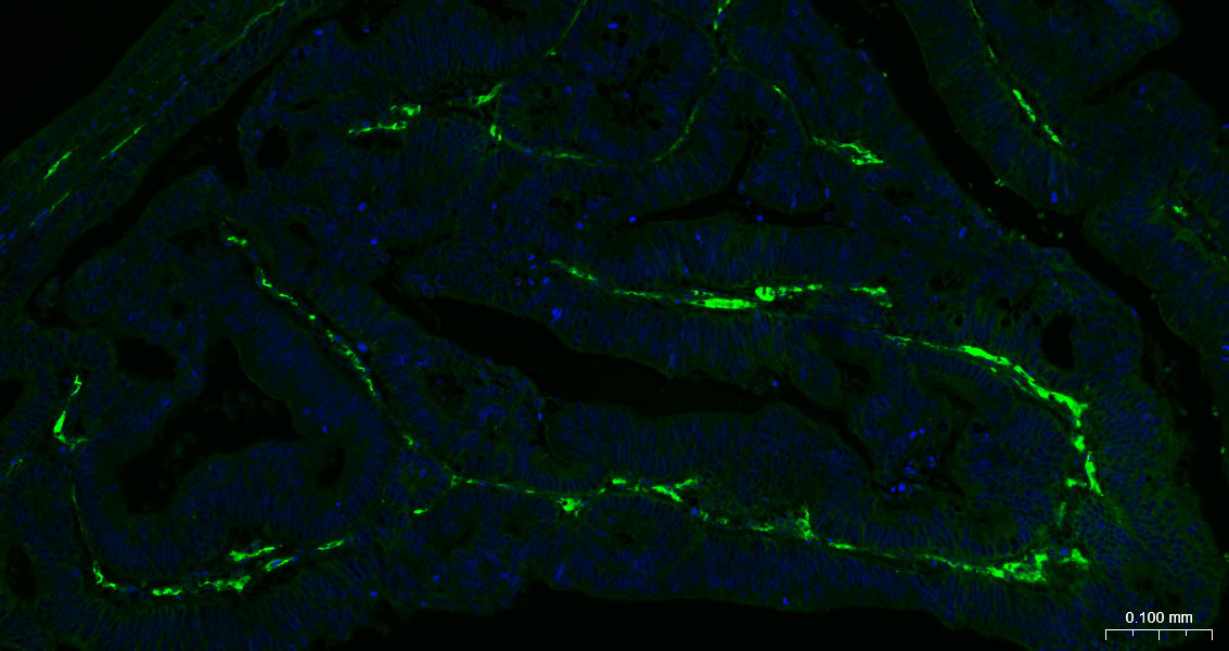 CD105重组兔单抗-bsm-61042R