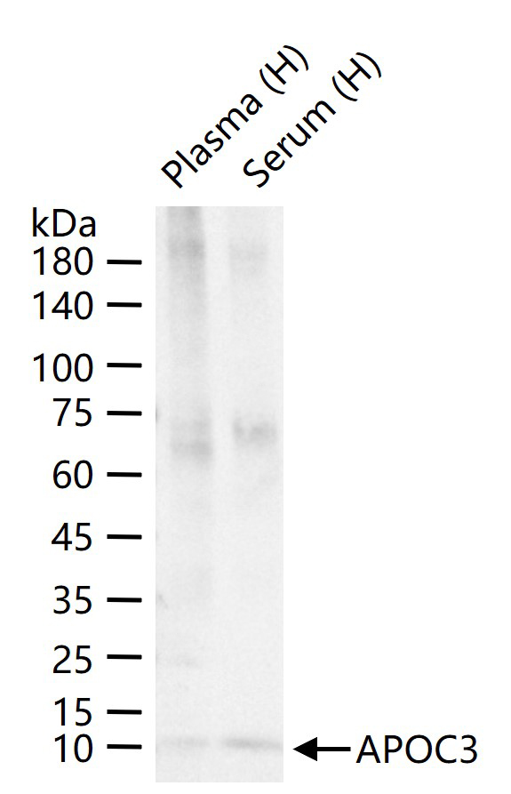 载脂蛋白C3重组兔单抗