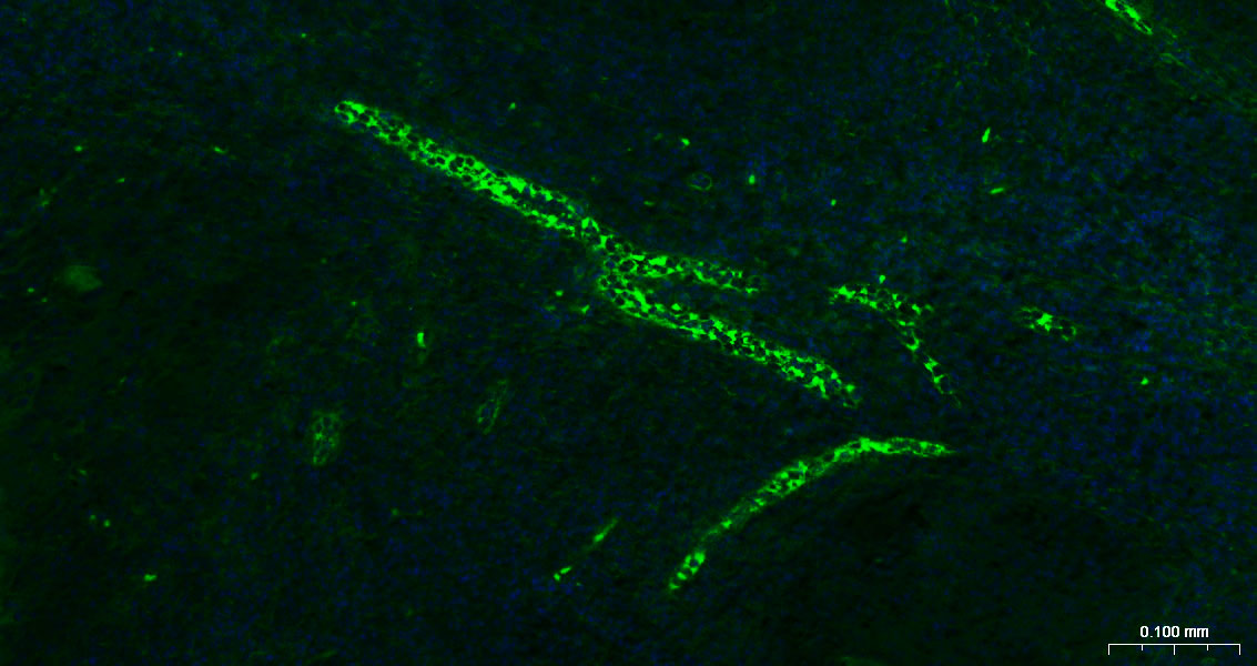 P选择素/白细胞内皮细胞粘附分子3重组兔单抗