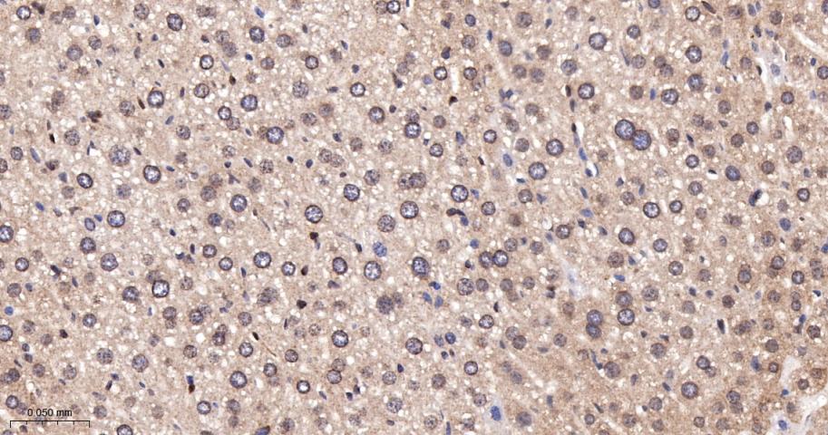 类泛素蛋白1重组兔单抗