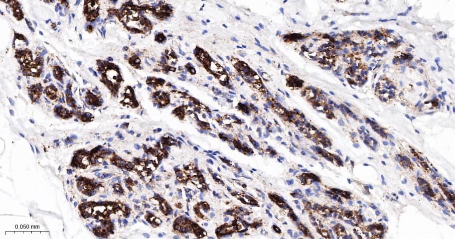 辣椒素受体5重组兔单抗