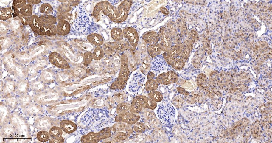 胰岛素样生长因子结合蛋白7重组兔单抗