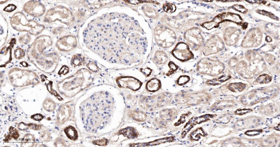 辣椒素受体5重组兔单抗