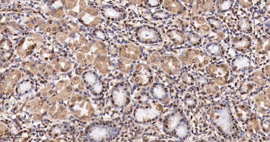 类泛素蛋白1重组兔单抗