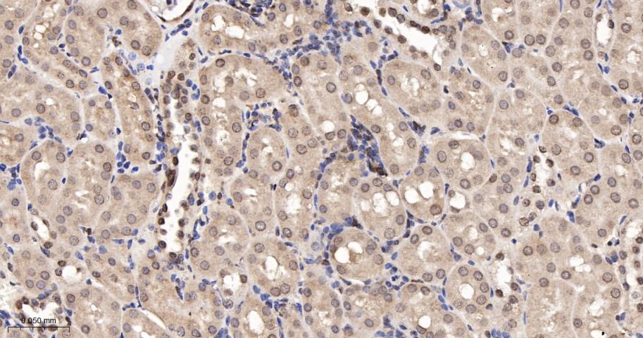 类泛素蛋白1重组兔单抗