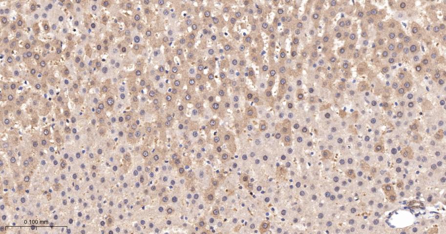 类泛素蛋白1重组兔单抗