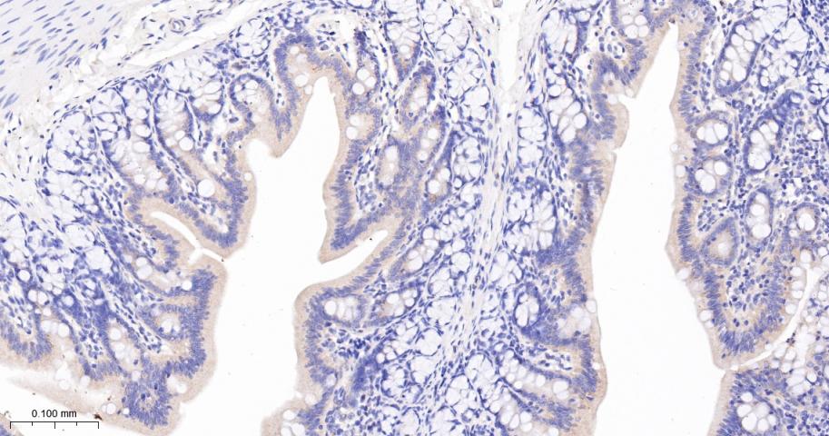 腺瘤样息肉重组兔单抗