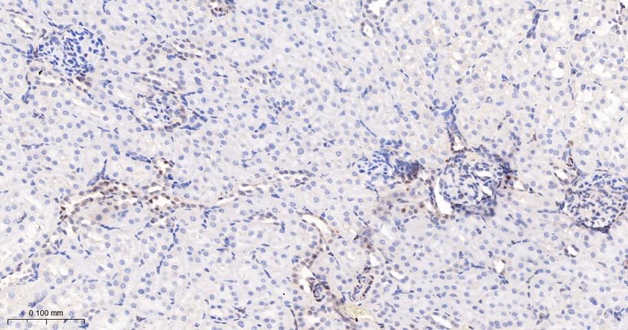 泛素样蛋白Sumo2/3重组兔单抗