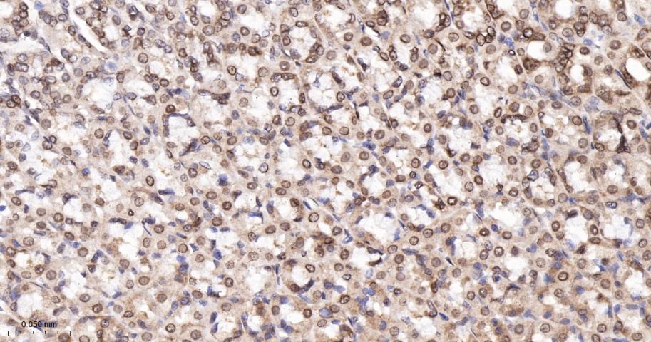 类泛素蛋白1重组兔单抗