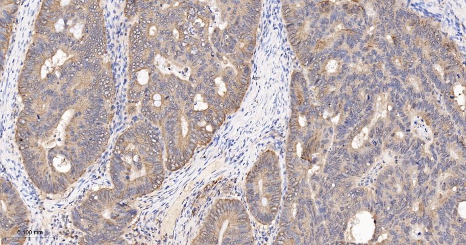 BH3结构域凋亡诱导蛋白重组兔单抗