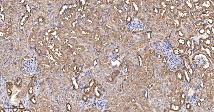 辣椒素受体5重组兔单抗