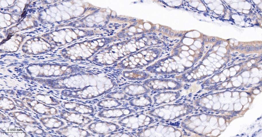 腺瘤样息肉重组兔单抗