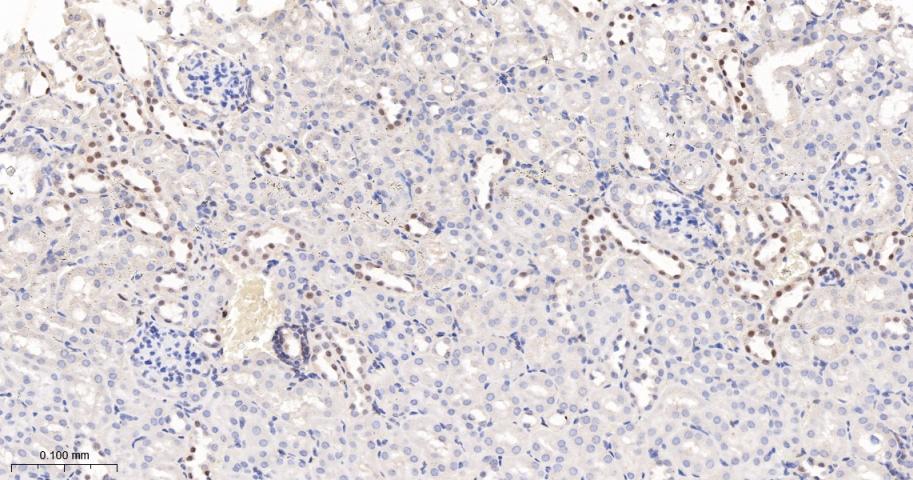 泛素样蛋白Sumo2/3重组兔单抗