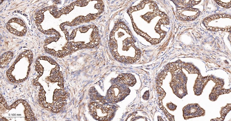 BH3结构域凋亡诱导蛋白重组兔单抗