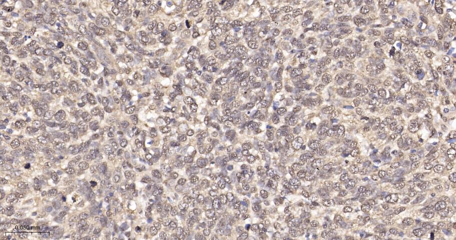 类泛素蛋白1重组兔单抗