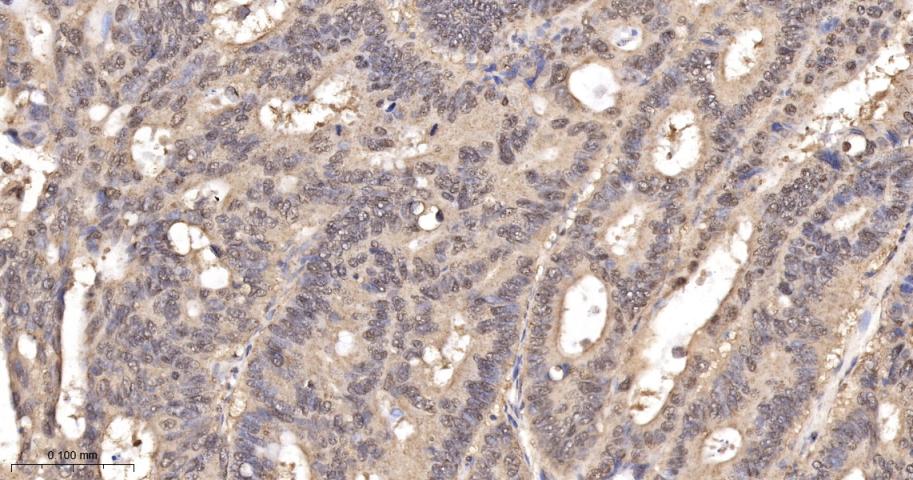 类泛素蛋白1重组兔单抗