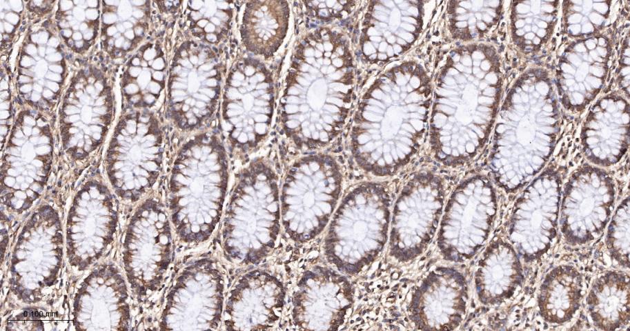 BH3结构域凋亡诱导蛋白重组兔单抗