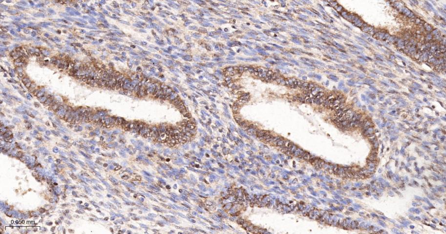 类泛素蛋白1重组兔单抗