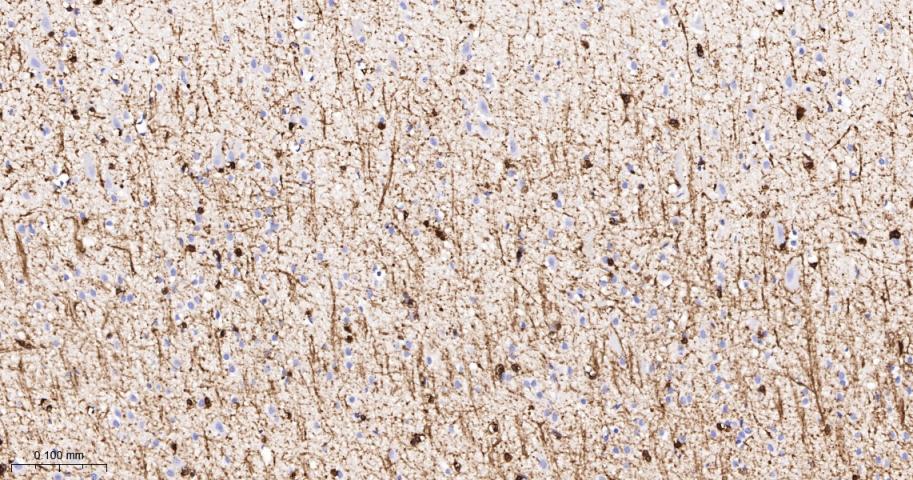 α晶状体球蛋白B/αB-crystallin重组兔单抗-bsm-61511R