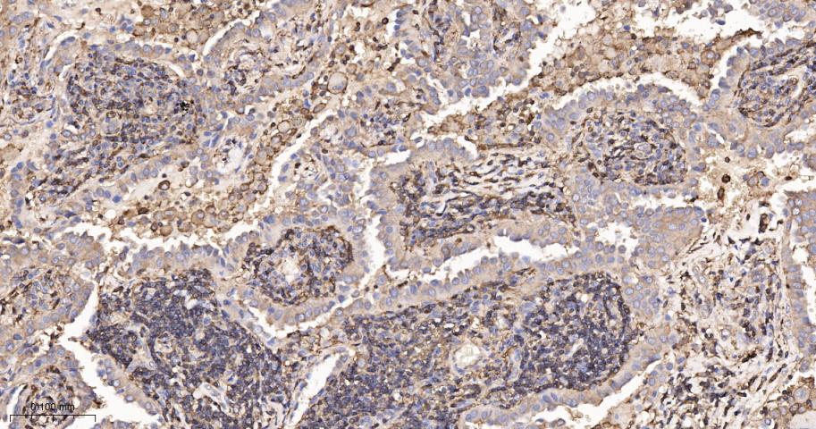 β-肌动蛋白/β-Actin(内参)抗体