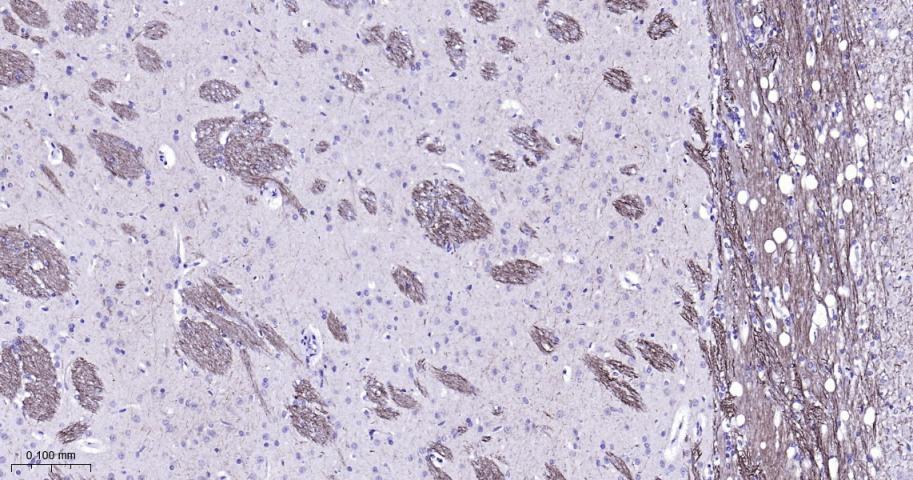 低分子量神经丝蛋白单克隆抗体-bsm-41217M