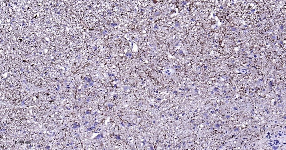 低分子量神经丝蛋白单克隆抗体-bsm-41217M