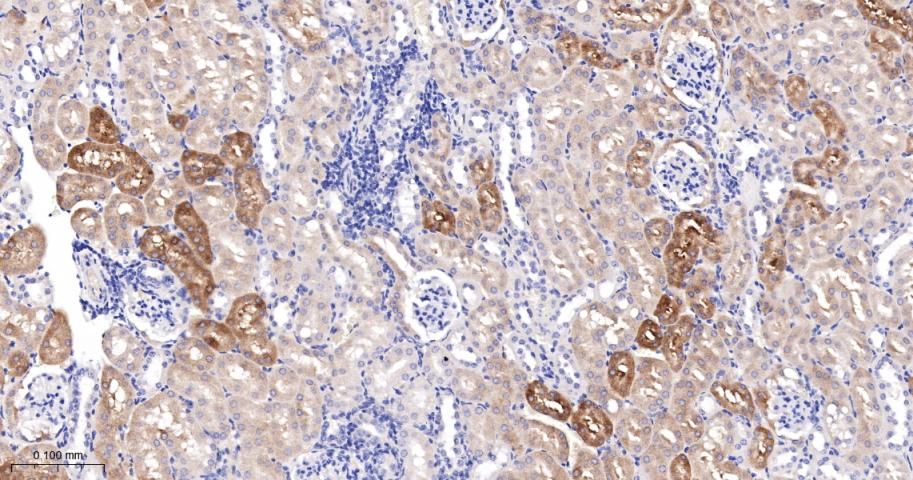 胰岛素样生长因子结合蛋白7重组兔单抗
