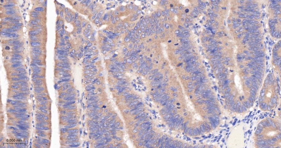腺瘤样息肉重组兔单抗