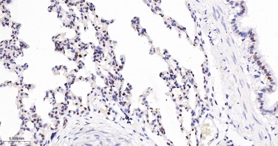 泛素样蛋白Sumo2/3重组兔单抗