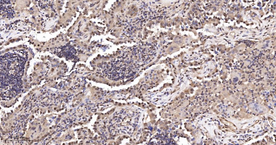 类泛素蛋白1重组兔单抗
