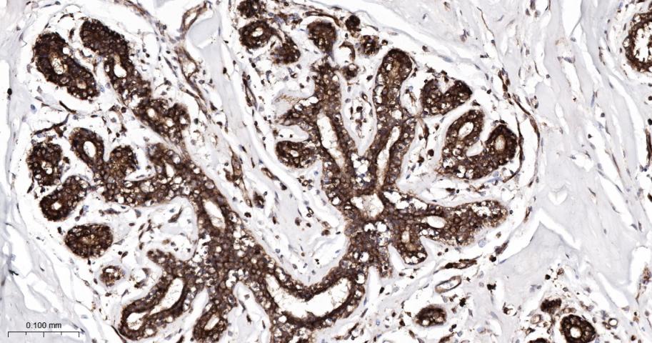 辣椒素受体5重组兔单抗
