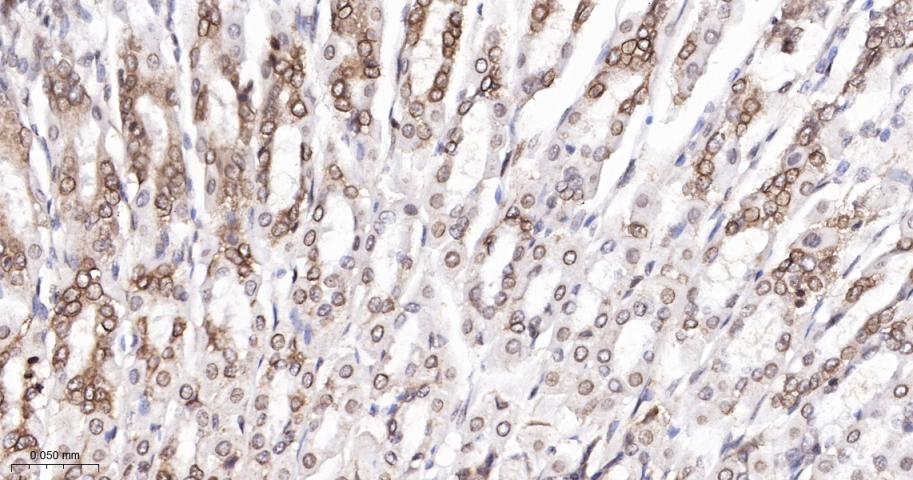 类泛素蛋白1重组兔单抗