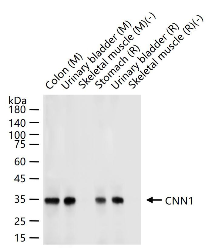 钙调节蛋白-1重组兔单克隆抗体