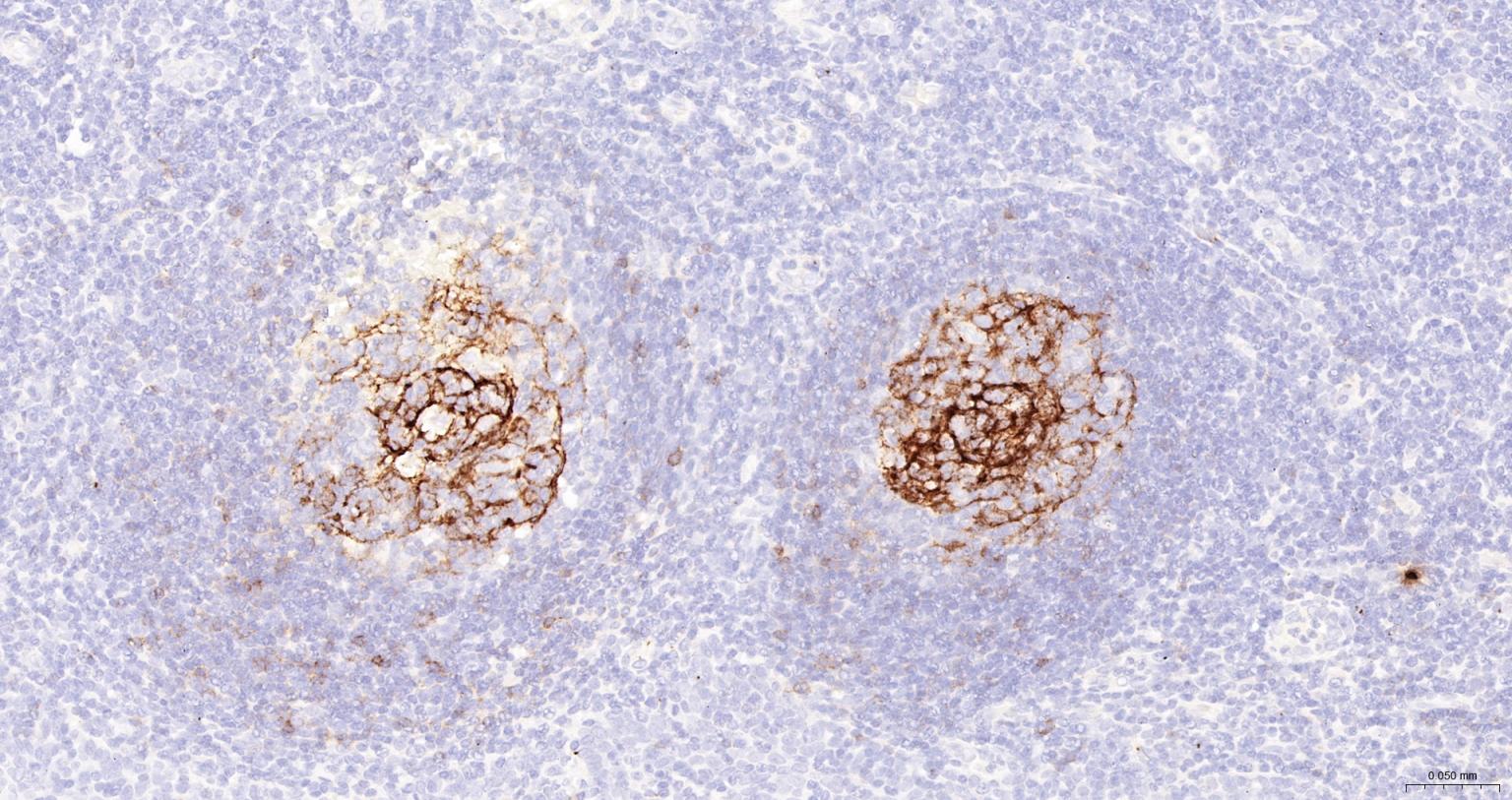 FCER2/CD23 Mouse mAb (一抗) - IHC-P,IHC-F,IF | Bioss