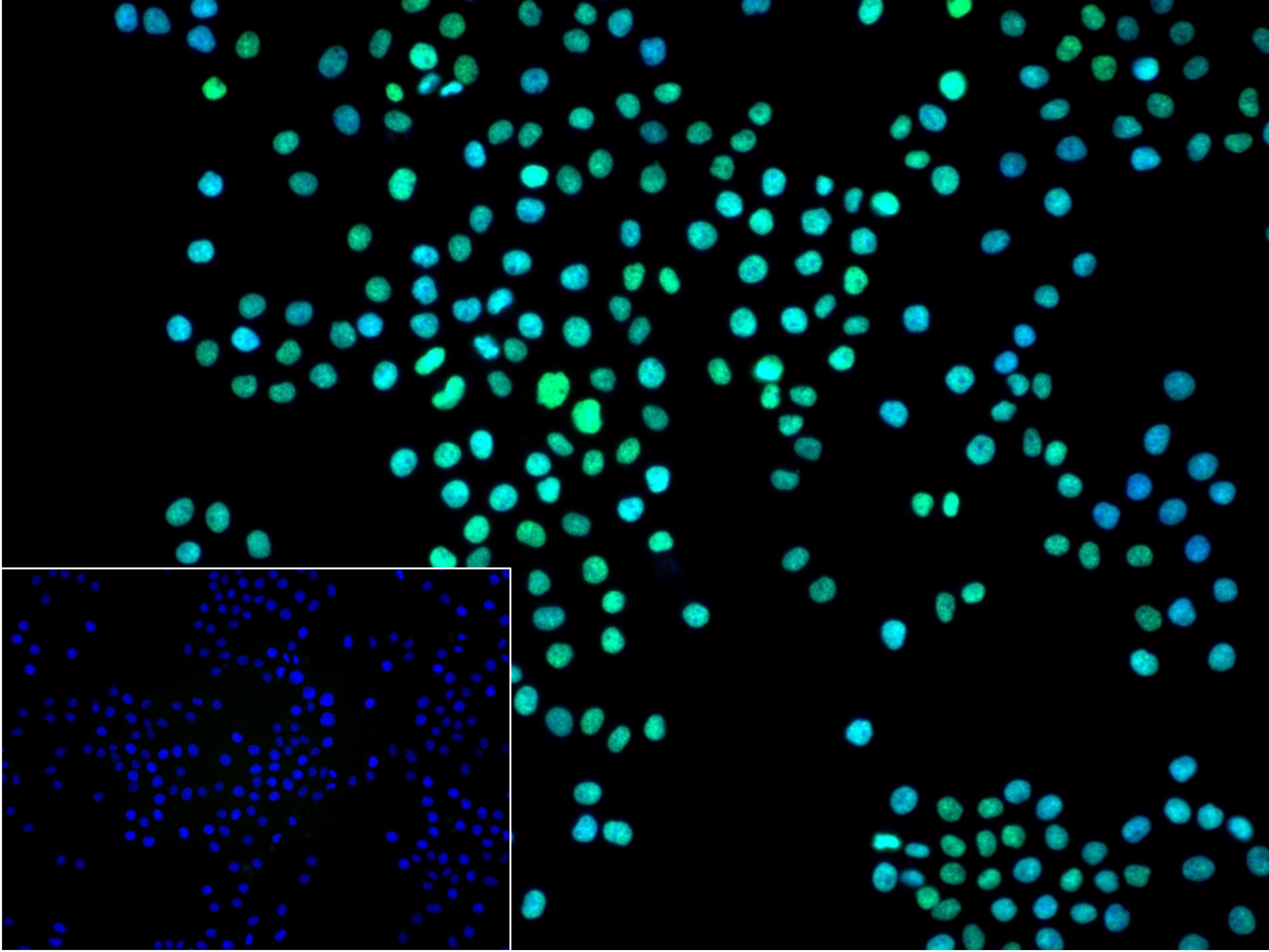 异型组蛋白H2A.1重组兔单抗-bsm-61665R