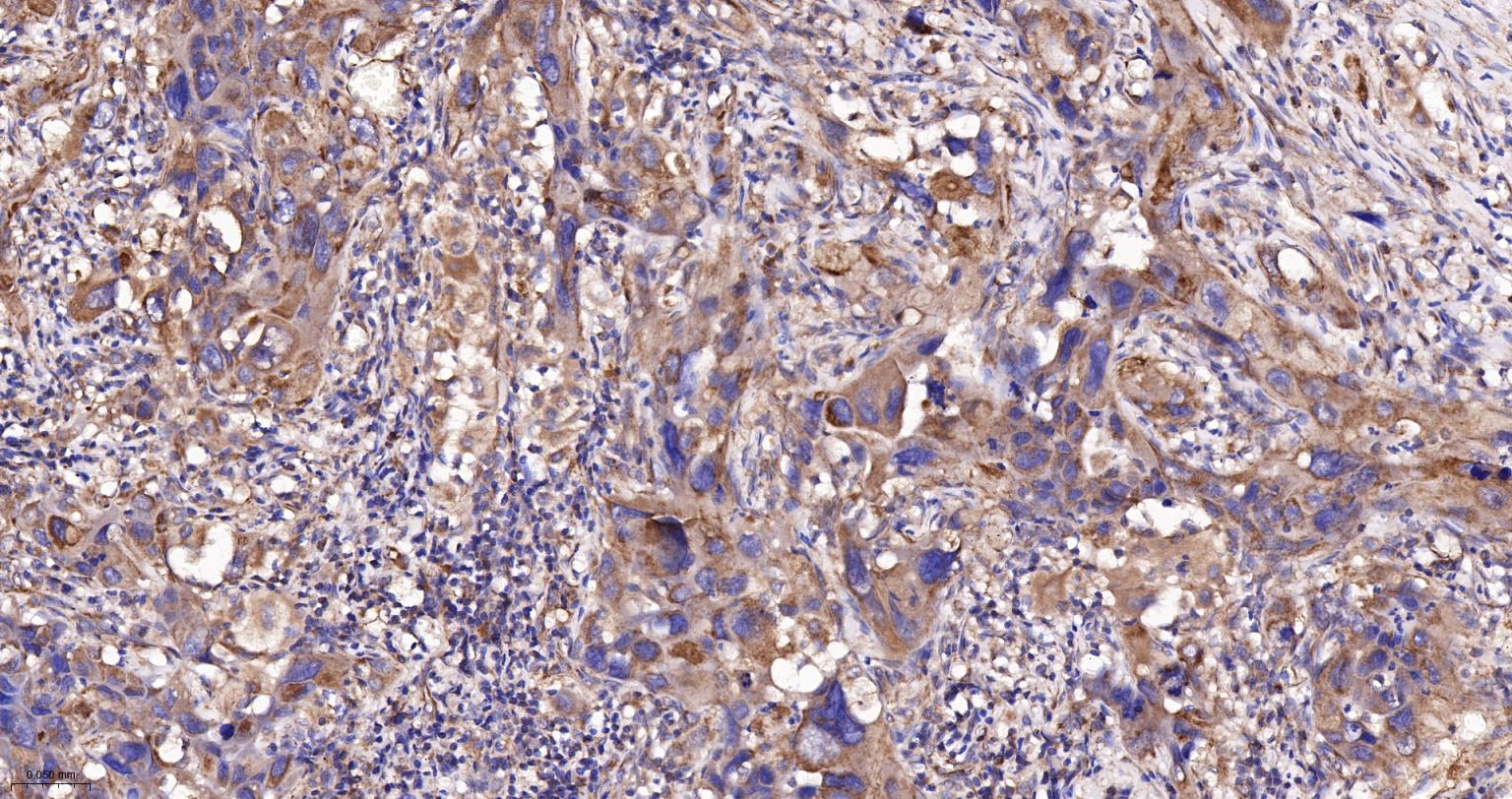 己糖激酶1重组兔单抗